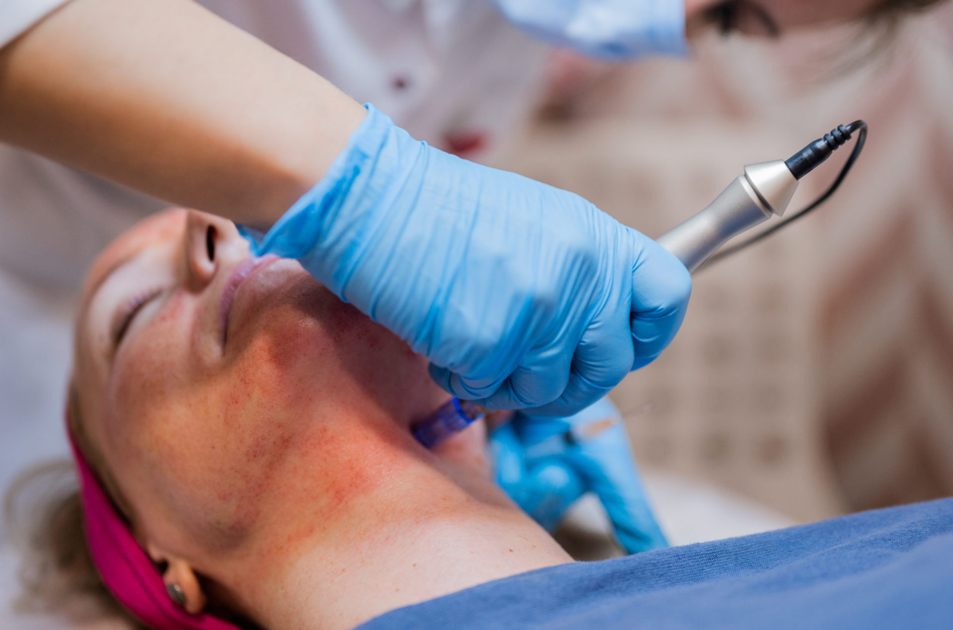 prp treatment in bakersfield